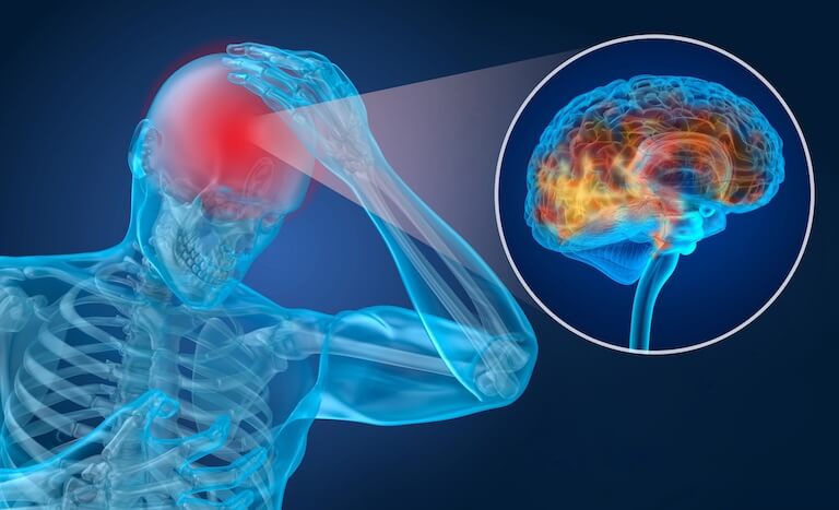 An illustration of brain activity after a head injury