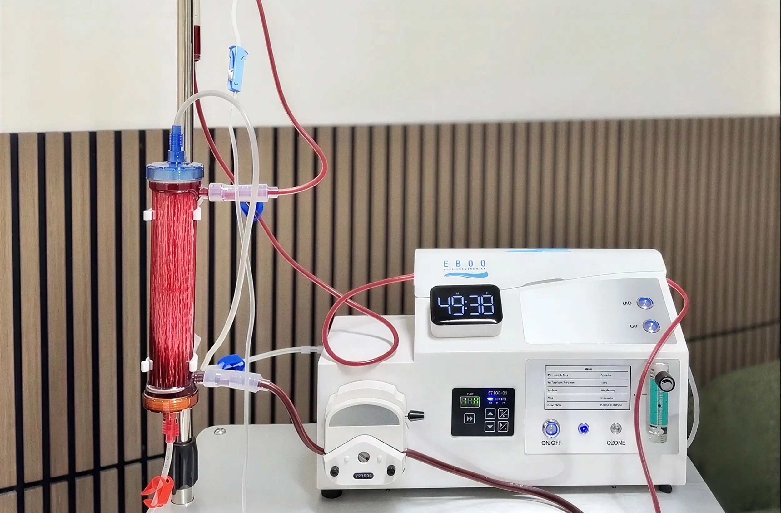 The EBOO system, with blood circulating through the dialysis filter beside the ozone unit